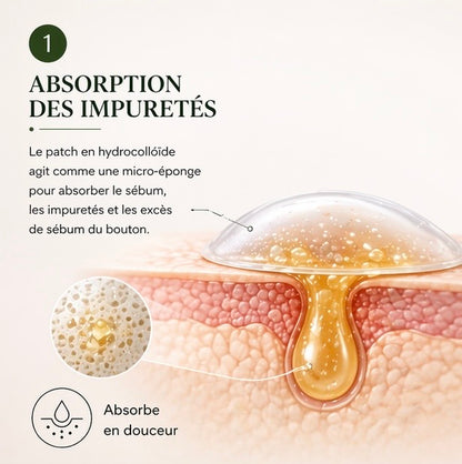 Patchs boutons invisibles hydrocolloïdes – action rapide nuit & jour